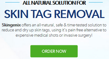 Why Do We Get Skin Tags